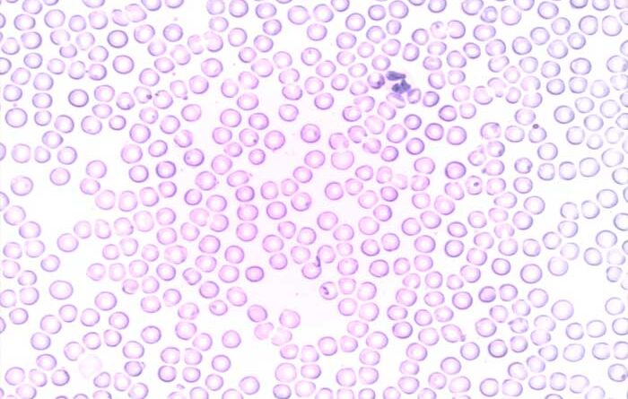Pengertian Neutrofil, Jenis Sel Darah Putih